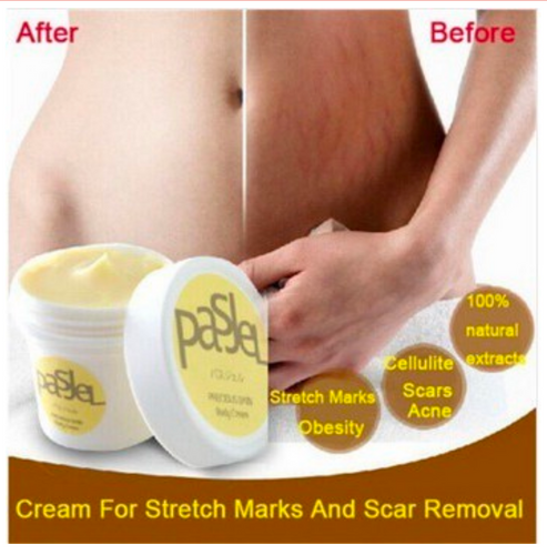 Pasjel Stretch Mark and Scars Whitening Cream